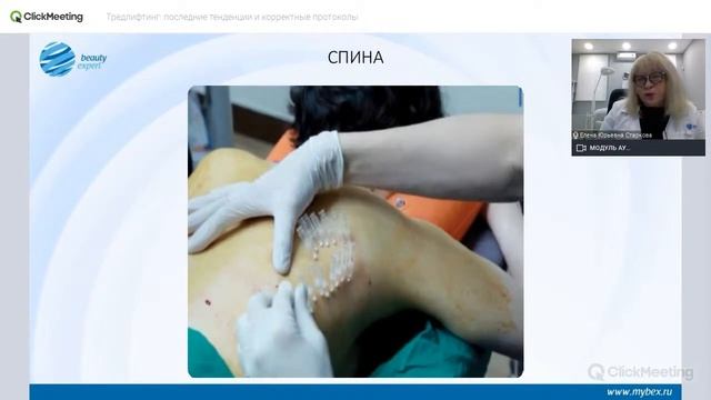 Вебинар «Тредлифтинг 2020: последние тенденции и корректные протоколы» смотреть онлайн