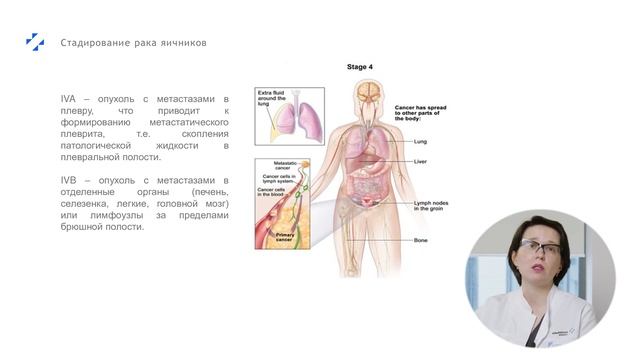 Рак яичников. Лекция для пациентов смотреть онлайн