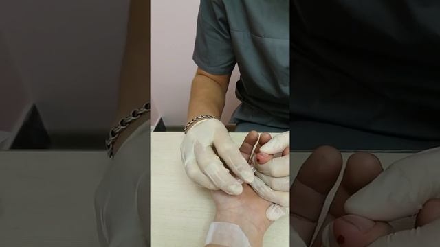 взятие  крови из пальца в лучшей лаборатории Уфы - лаборатория  "Лорак"