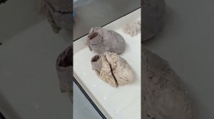 Анатомия. Строение сердца, основные его части и структуры. Функции сердца.