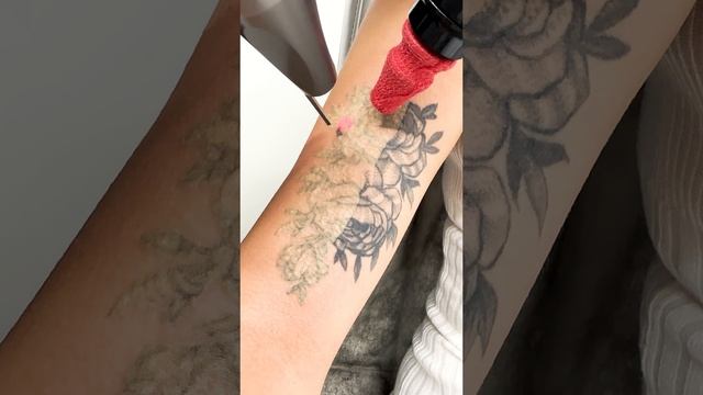 ASMR - Удаление тату на руке ✅ #tattoo #удалениетату | студия  "Битый Небитого" САНКТ-ПЕТЕРБУРГ
