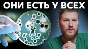 ОНИ ЕСТЬ У ВСЕХ - Кандиды. Как избавиться от молочницы?