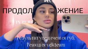 Продолжение.Процесс увеличения губ. Реакция ребят с vdkteam