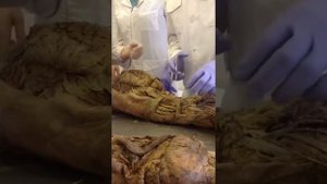 Топографическая анатомия плеча