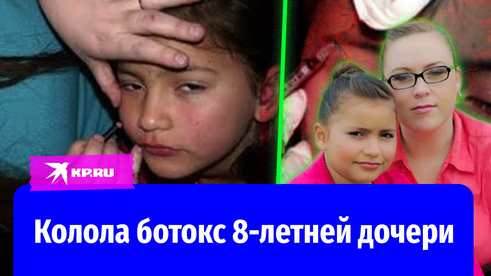 Колола ботокс 8-летней дочери