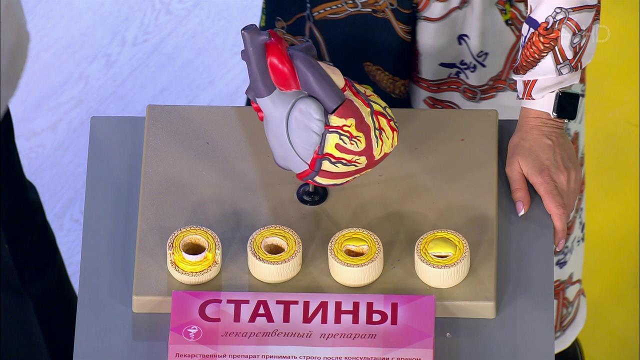 Холестерин - снижать! Жить здорово! Фрагмент выпуска от 23.10.2018