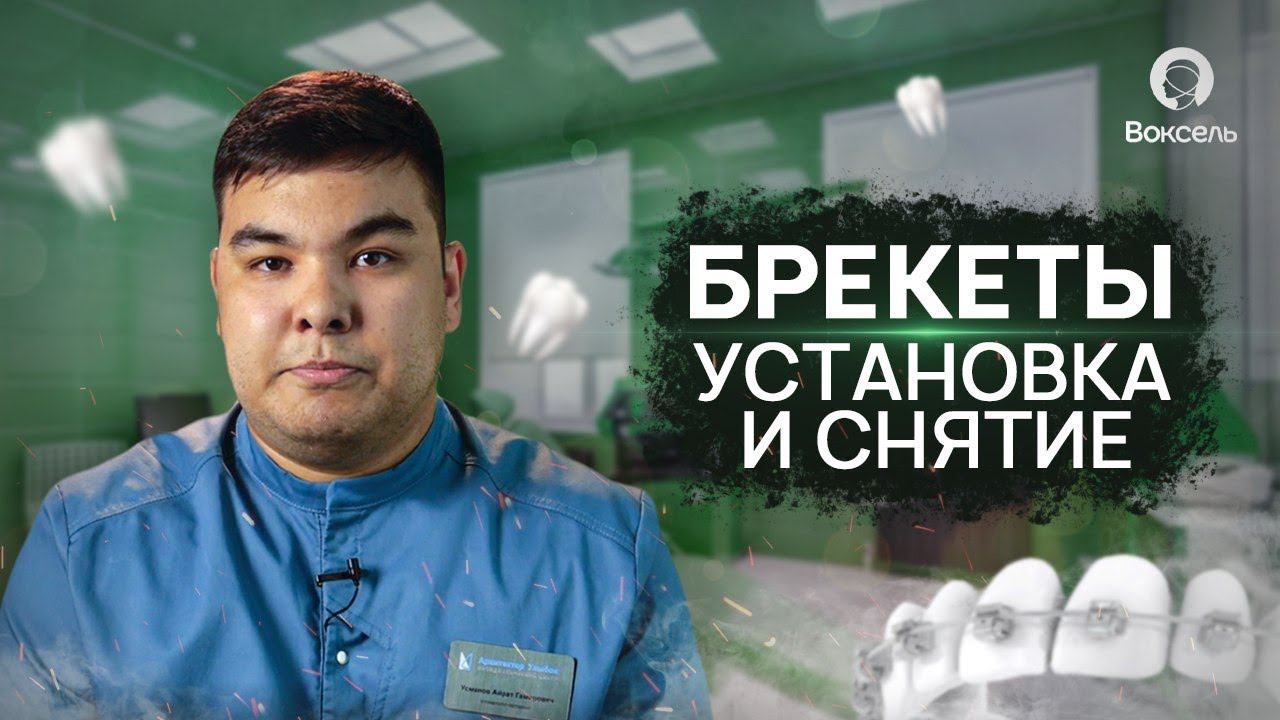 Установка и снятие брекетов | Сколько стоят брекеты? | Voxel