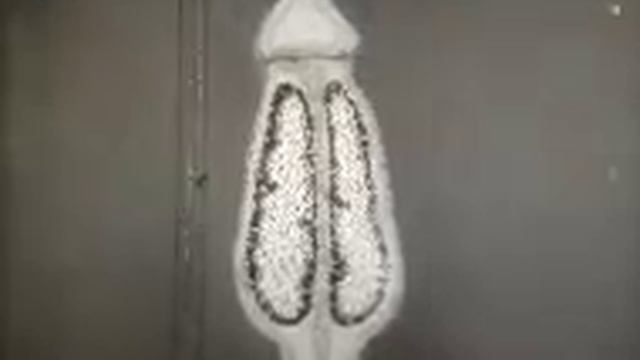 Зелёный мох- кукушкин лён_1 смотреть онлайн