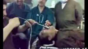 Иракский солдат проглотил гаечный ключ. Хирурги вытаскивают.