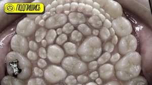 SCP ИСТОРИИ:SCP- 478 "Зубная фея"