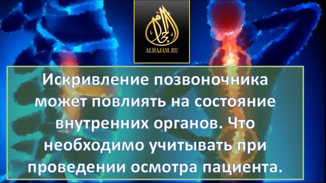 Вред сколиоза. Обучение хиджаме