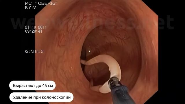 Паразиты, которые в нас обитают или как работает биорезонанс