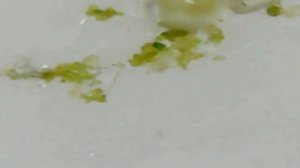 Постельный (бельевой) клещ под микроскопом Х1250-Х1600