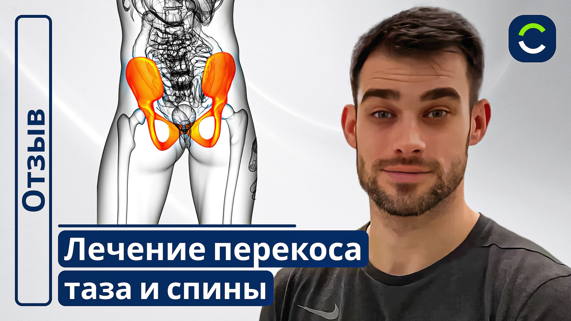 Лечение Перекосов в Спине и Тазу | Отзывы Наших Пациентов