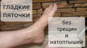 Гладкие пяточки! Без Трещин и Натоптышей! Супер средство для ног!