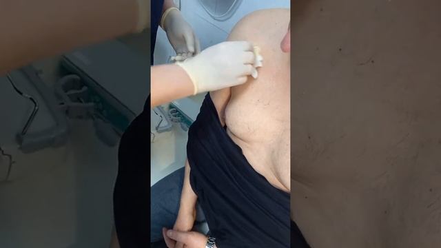 Как поставить иглу Губера/Сурекан в порт-систему? смотреть онлайн