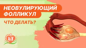 ?⚕️ Неовулирующий фолликул / Персистенция фолликула - что делать?