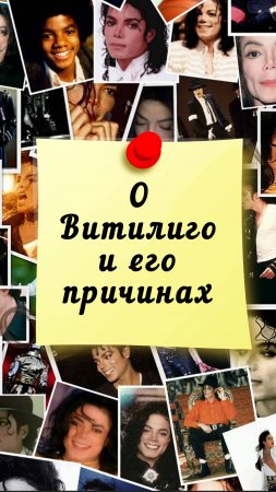 Майкл Джексон о Витилиго и его причинах - Ченнелинг - Ирина Подзорова