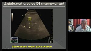 УЗД заболеваний печени 3  Неласов Н Ю