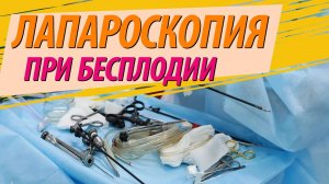 Лапароскопия при бесплодии. ЖЕНСКОЕ БЕСПЛОДИЕ💊