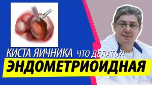 Выявлена ЭНДОМЕТРИОИДНАЯ киста яичника - инструкция что делать