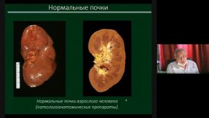 УЗД заболеваний почек Часть 1 зав каф проф Неласов Н Ю