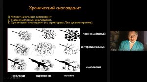 Ультразвуковая диагностика патологии слюнных желез  Часть 4