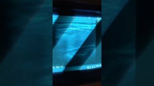 Практическое занятие 1. Методика УЗИ щитовидной железы (Н.Ю. Неласов)