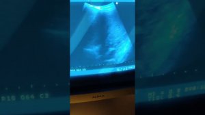 Техника УЗИ почек (1)