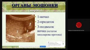 УЗД заболеваний органов мошонки  Паленый А И