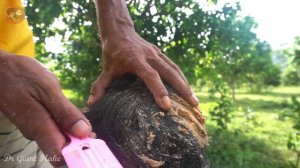 OMG! Dandruff Removal Scalp OnFront Side Head!! Best Scratching Dandruff #356