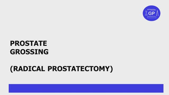 Prostate (radical prostatectomy) grossing