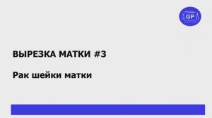Гистологическое исследование (вырезка) матки #3  - рак шейки матки