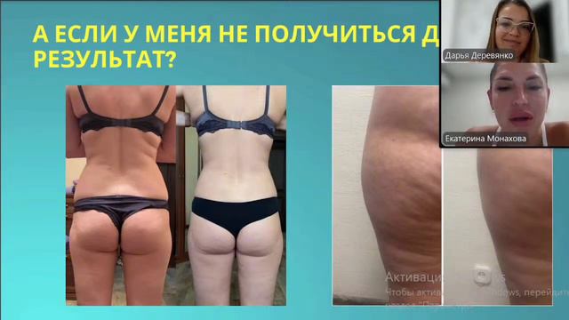 Ручная липопластика. Противопоказания и последствия процедуры.