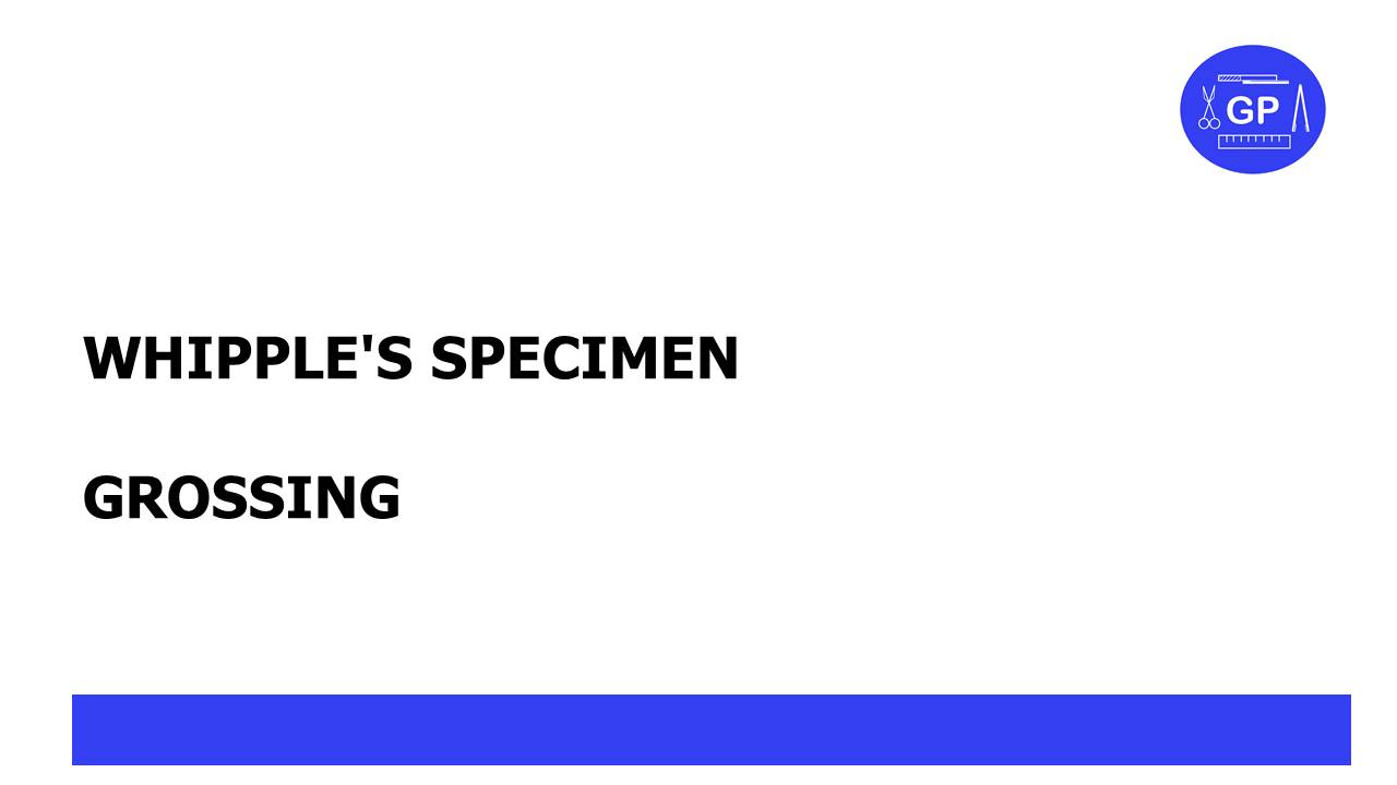 Whipple specimen gross pathology
