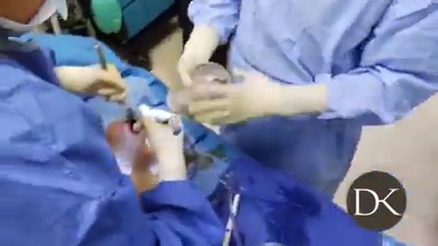 Large Breast Augmentation happy life смотреть онлайн