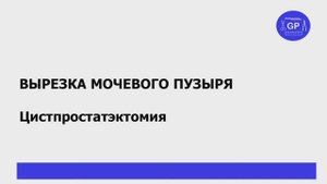Рак мочевого пузыря (цистпростатэктомия) - гистологическое исследование (вырезка)