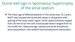 Dumb bell sign in lipomatous hypertrophy of the atrial septum