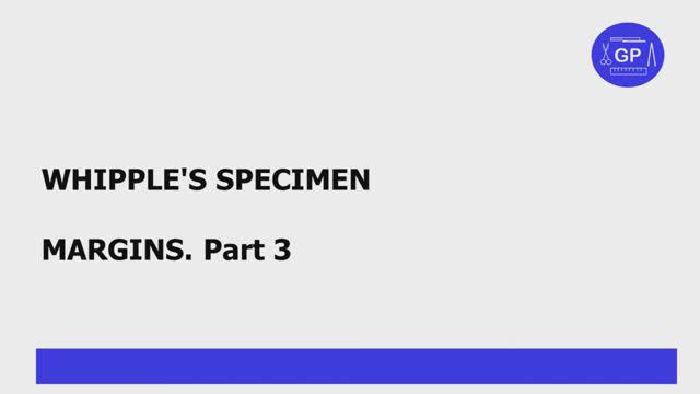 Whipple’s specimen (pancreaticoduodenectomy) margins. Part 3