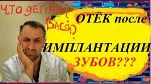 Имплант 12.Отек после имплантации, что делать??? #имплант #имплантация зубов #Стоматолог