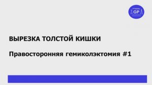 Рак толстой кишки #1 - гистологическое исследование