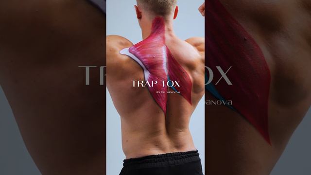 TRAP TOX
Инъекции нейропротеина по телу.