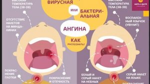 Септопластика. Что не скажут врачи. Мой опыт.