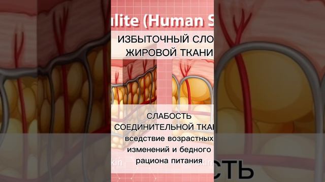 #Топ 3 #причины #целлюлита. #agenyz #питание #здоровье #витамины #худеемправильно  #minerals