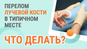 Перелом лучевой кости в типичном месте - что делать