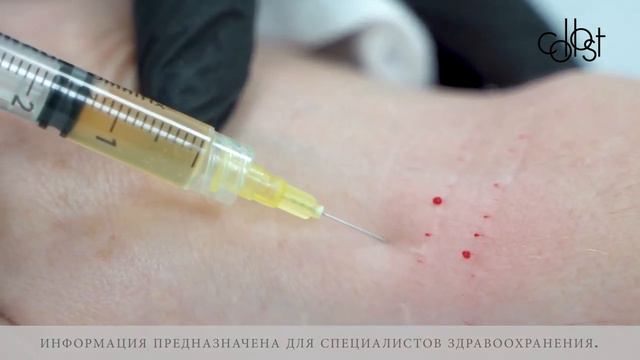 МАСТЕР-КЛАСС «Коррекция возрастных изменений рук с помощью геля COLLOST®» смотреть онлайн