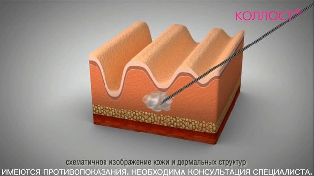Как работает гель КОЛЛОСТ® смотреть онлайн