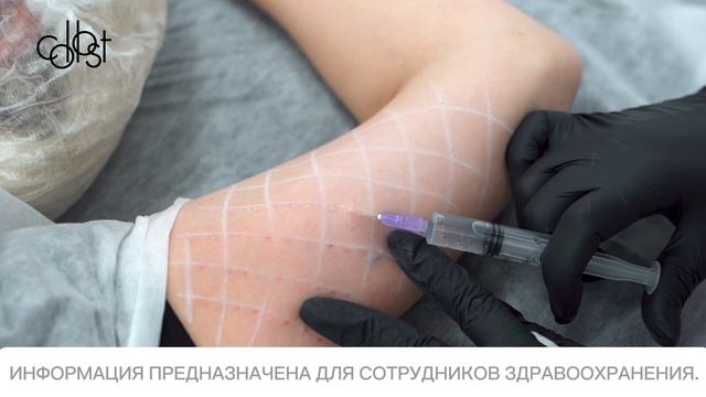 МАСТЕР-КЛАСС «Коррекция возрастных изменений внутренней поверхности плеча с помощью COLLOST® micro» смотреть онлайн