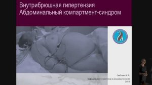 Синдром абдоминального компартмента