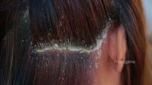 Amazing Big Flake In My Mother Hair!! Many Dandruff Scratching Scalp #